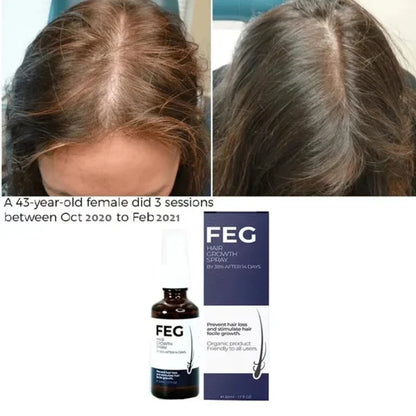 FEG PLUS Hair Growth Spray SERUM